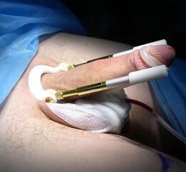 How is a function to be performed to increase penis